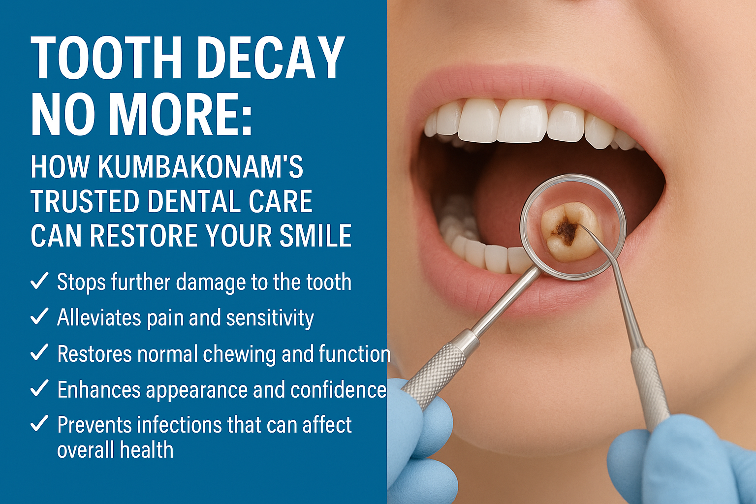 Tooth Decay Treatment In Kumbakonam