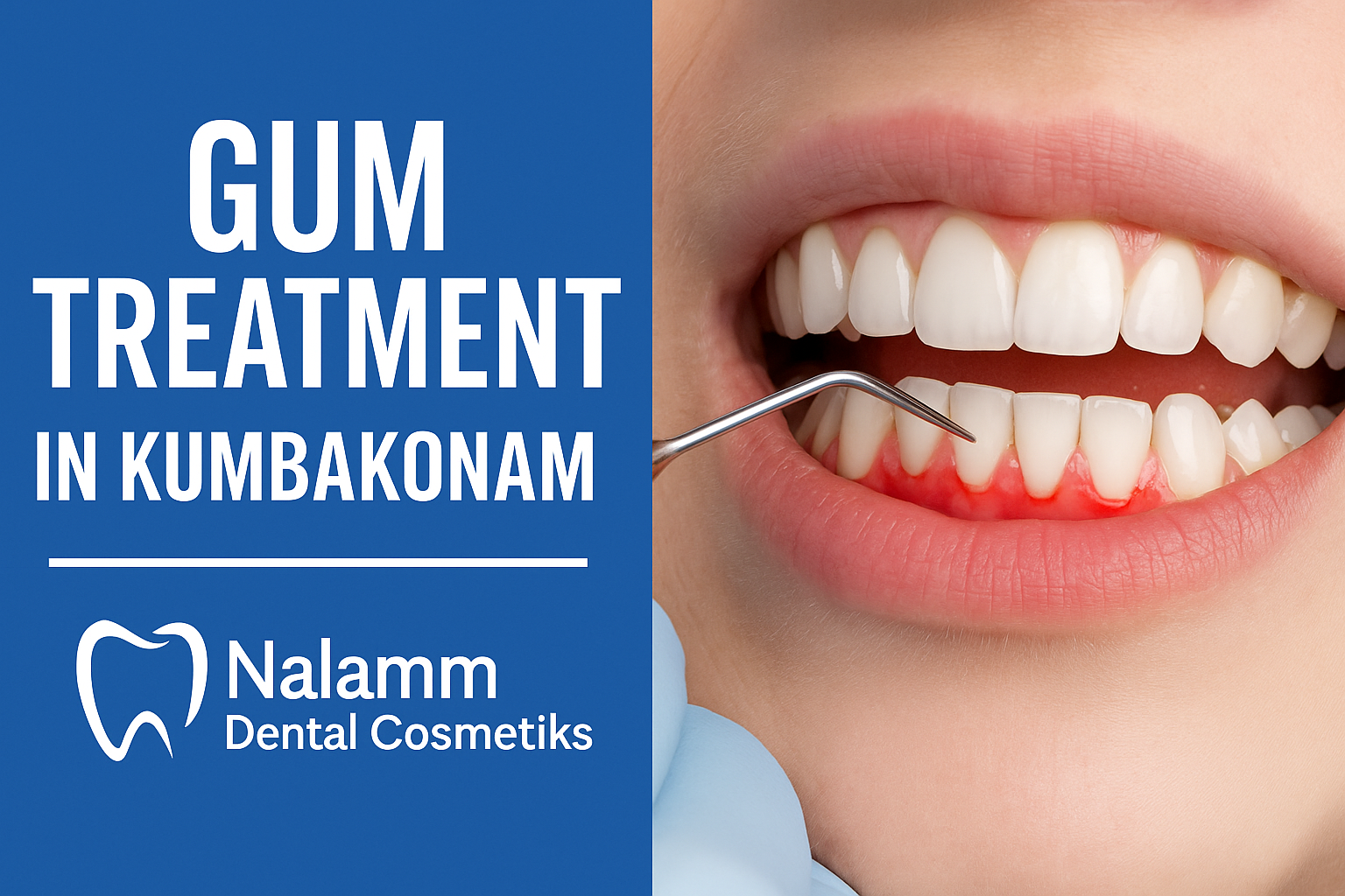 Gum Treatment in Kumbakonam