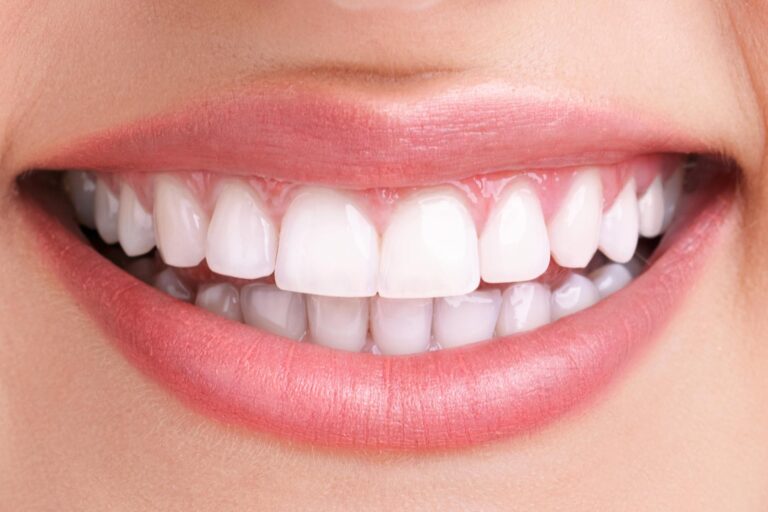 "Safe, Fast & Effective Teeth Whitening Services – Nalamm Dental Cosmetiks"