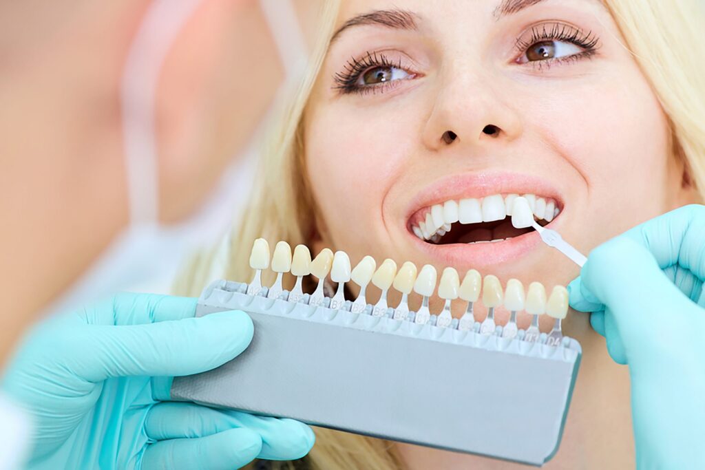"Brighten Your Smile with Professional Teeth Whitening Services – Nalamm Dental Cosmetiks"