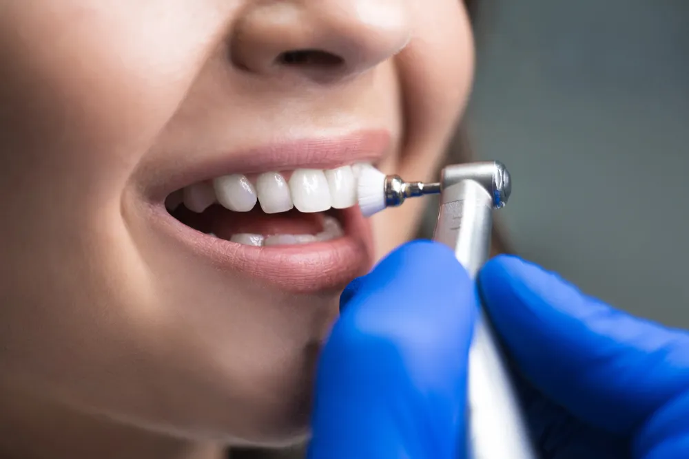 "Scaling and Polishing of Teeth: Discover Sparkling Smiles at Nalamm Dental Cosmetiks in Kumbakonam"