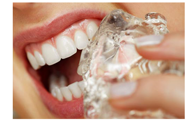 “Break Bad Habits, Build Bright Smiles – Habit Breaking Treatments at Nalamm Dental Cosmetiks”