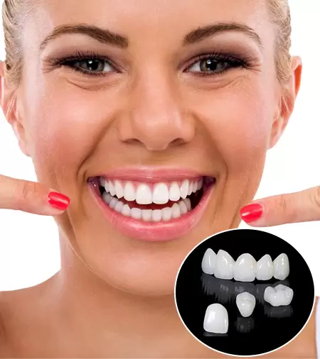 “Metal Free Crowns Services @ Nalamm Dental Cosmetiks in Kumbakonam: Redefining Natural Smiles.”