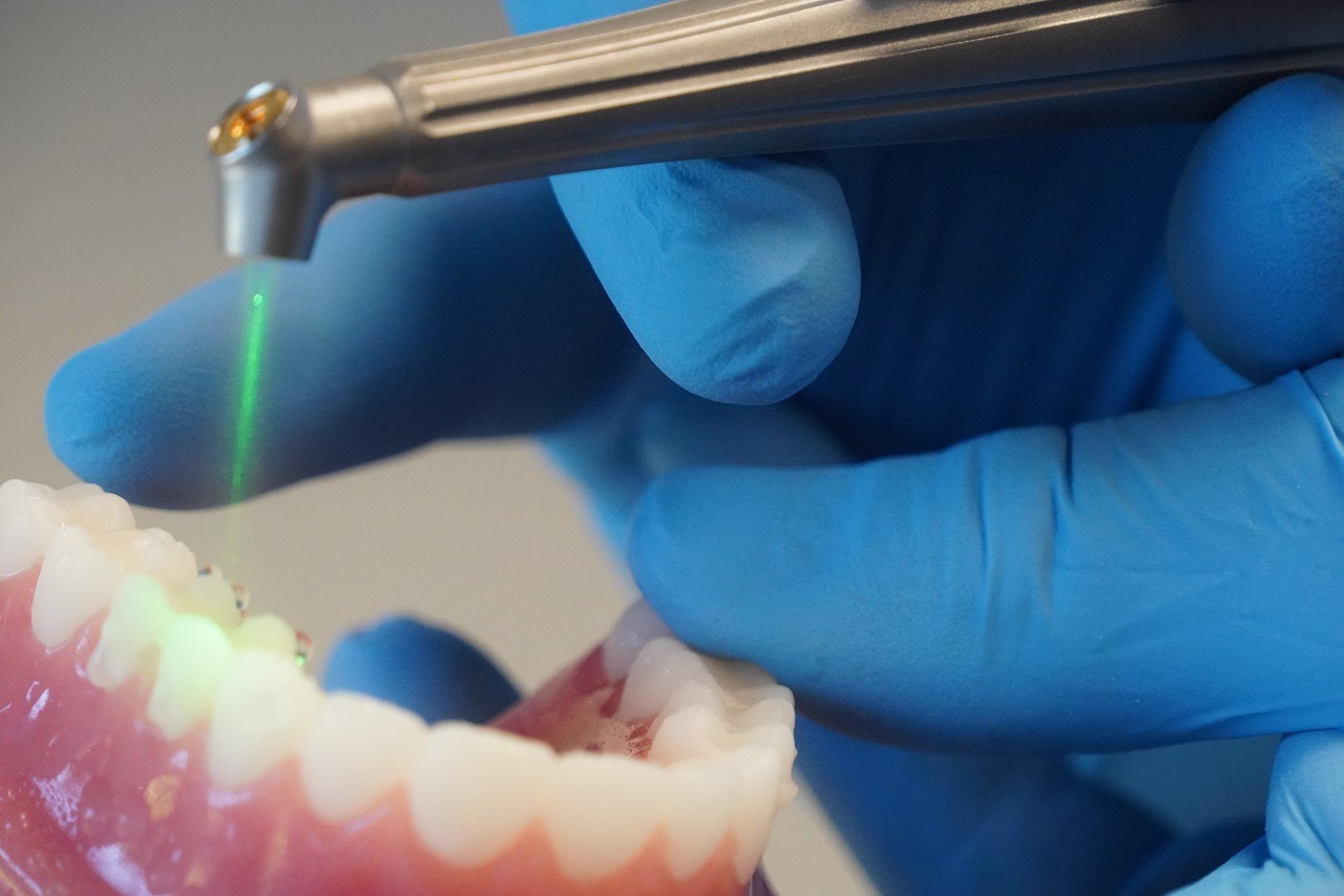 Ditch the drill, embrace the light! ✨ Laser Dentistry treatments in Kumbakonam – nalamm dental cosmetiks mean less pain, less bleeding, and faster healing. Perfect for gum contouring, deep cleaning, and anxiety-free visits!Ditch the drill, embrace the light! ✨ Laser Dentistry treatments in Kumbakonam – nalamm dental cosmetiks mean less pain, less bleeding, and faster healing. Perfect for gum contouring, deep cleaning, and anxiety-free visits!