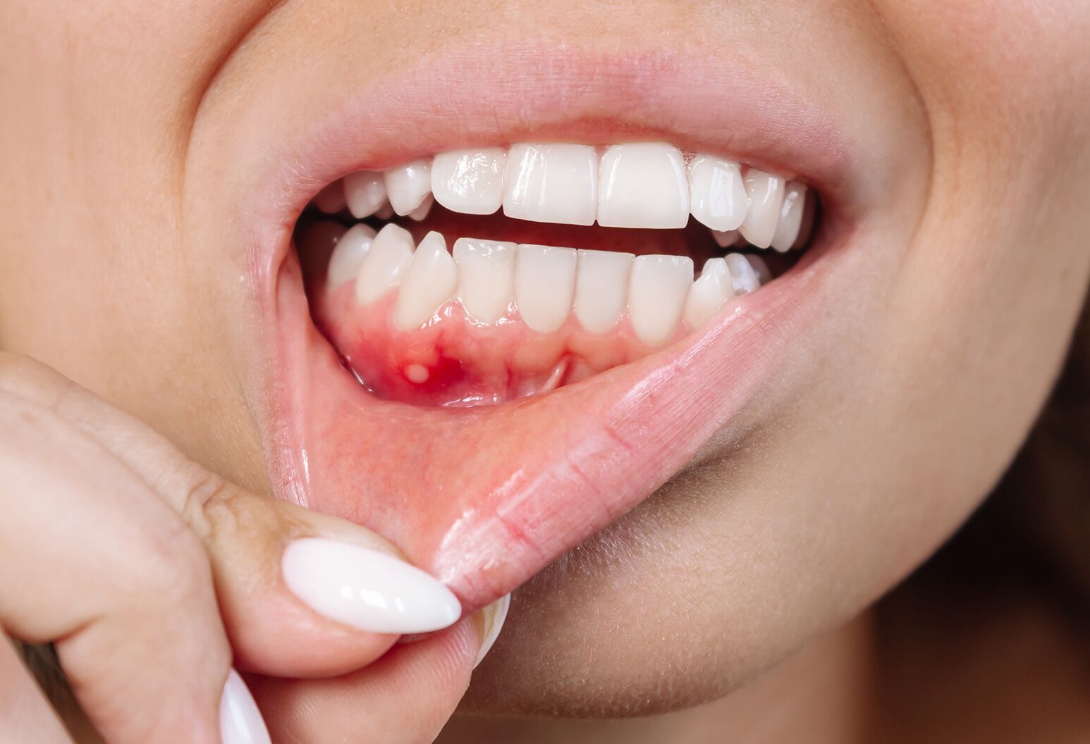 A Life-Saving Check: Why Oral Cancer Prevention Treatments – Nalamm Dental Cosmetiks in Kumbakonam is Non-Negotiable