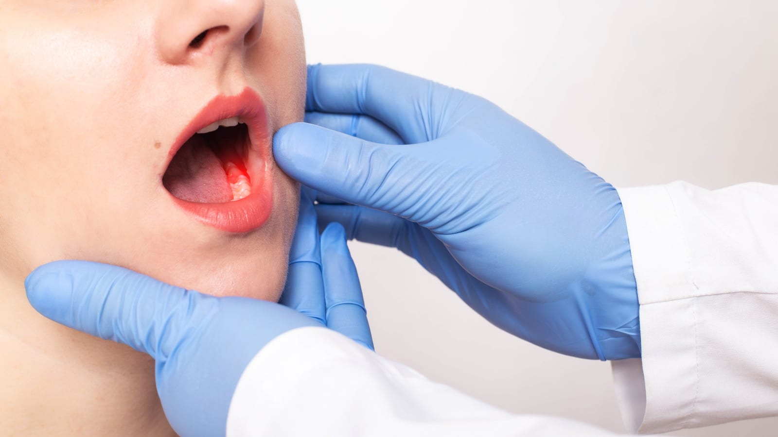 Don't skip the most important checkup! 📢 Oral cancer prevention treatments – nalamm dental cosmetiks in kumbakonam ensure life-saving early detection. Quick, painless screening is your first line of defense.