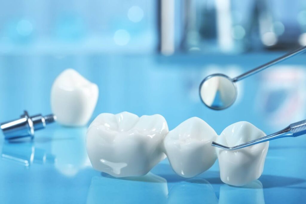 “Metal Free Crowns Services @ Nalamm Dental Cosmetiks in Kumbakonam: Redefining Natural Smiles.”