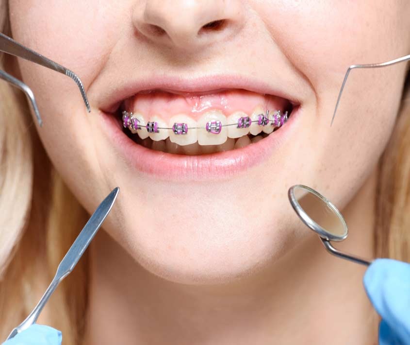The Architect of Your Smile: Mastering Alignment, Health, and Confidence with Orthodontics