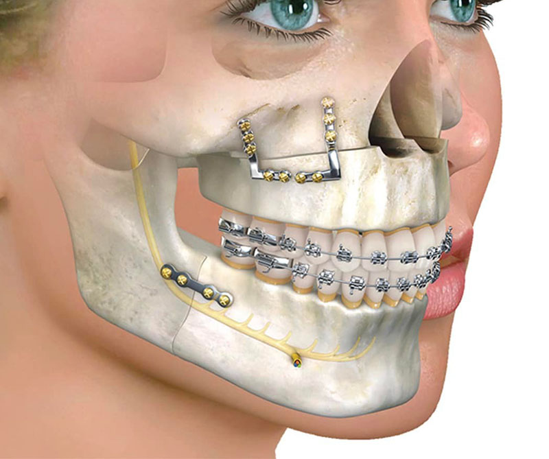 “Transform Your Smile, Transform Your Life – Orthognathic Surgery Treatments at Nalamm Dental Cosmetiks in Kumbakonam”