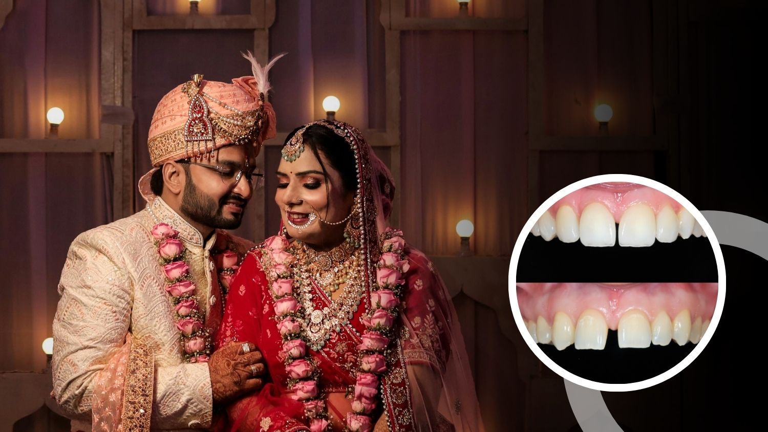 Bridal & Groom Smile Perfection Wedding Dentistry Services @ Nalamm Dental Cosmetiks in Kumbakonam 1