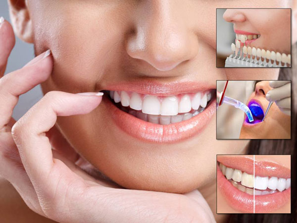 Best Dental Treatments Near Me – Nalamm Dental Cosmetiks in Kumbakonam