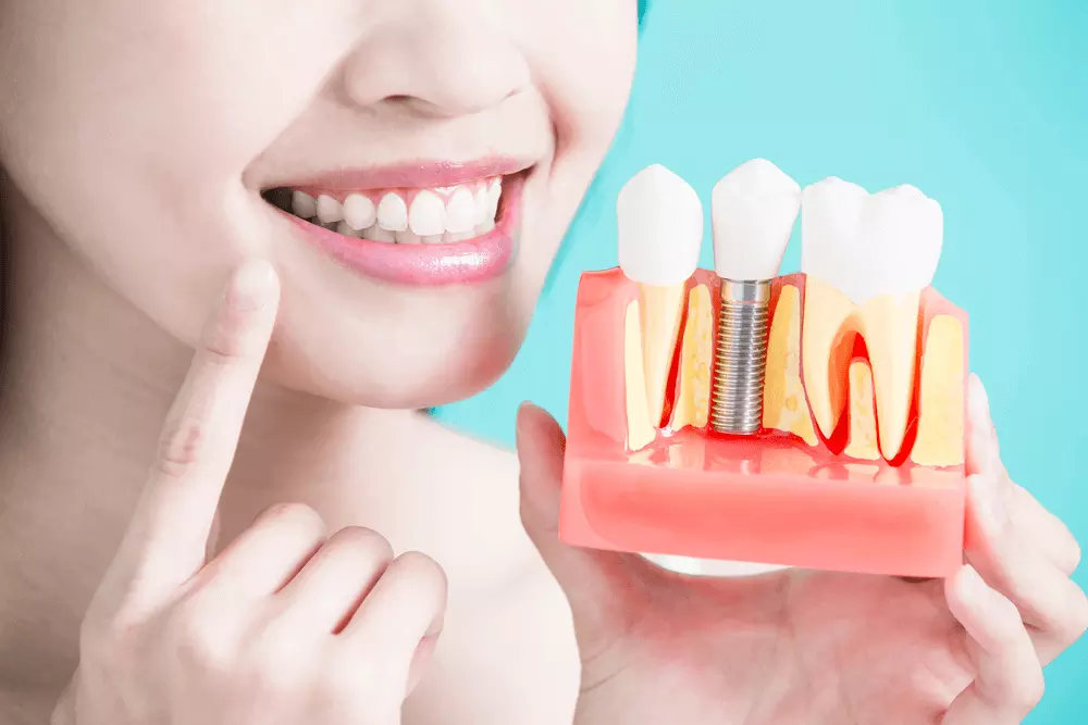 Dental Implant Clinic in Kumbakonam – Nalamm Dental Cosmetiks