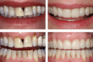 Best Gum Specialist in Kumbakonam | Nalamm Dental Cosmetiks