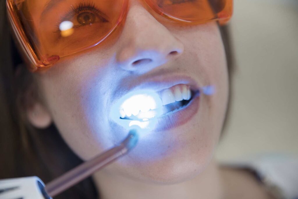 Best Laser Whitening Treatments – Nalamm Dental Cosmetiks in Kumbakonam