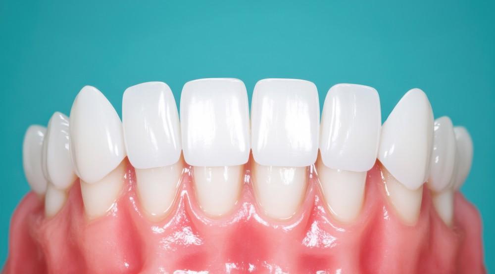 Lumineers Dental Treatments – Nalamm Dental Cosmetiks in Kumbakonam | Painless Smile Makeover