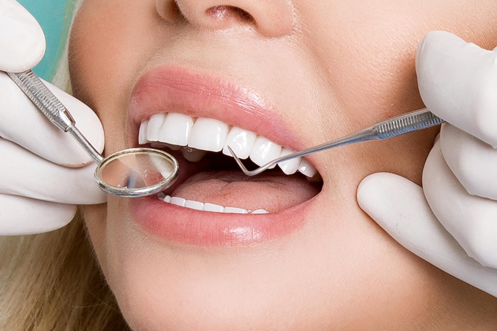 Professional Oral Hygiene Treatments in Kumbakonam – Nalamm Dental Cosmetiks