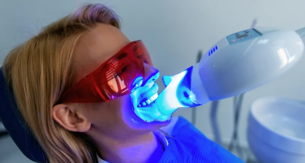 Laser Whitening in Kumbakonam – Nalamm Dental Cosmetiks