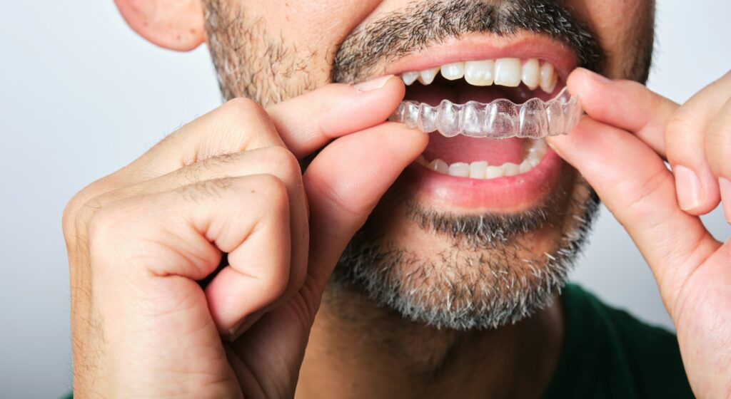 Orthodontic Retainers Treatments in Kumbakonam – Nalamm Dental Cosmetiks