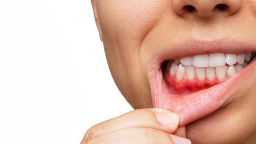 Periodontist Treatments in Kumbakonam – Nalamm Dental Cosmetiks