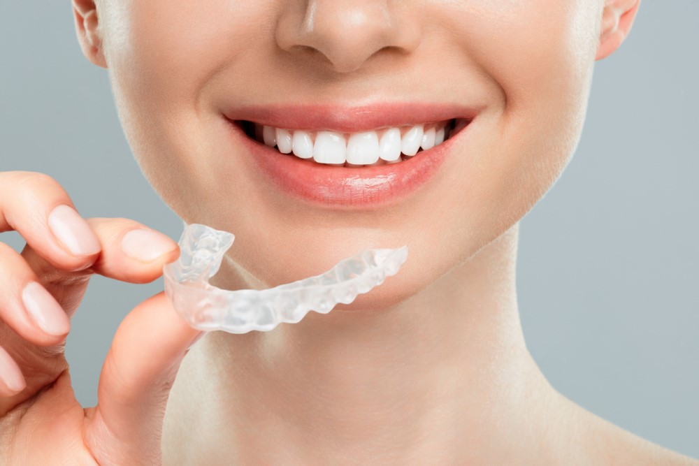 Invisalign Teeth Treatments in Kumbakonam – Nalamm Dental Cosmetiks
