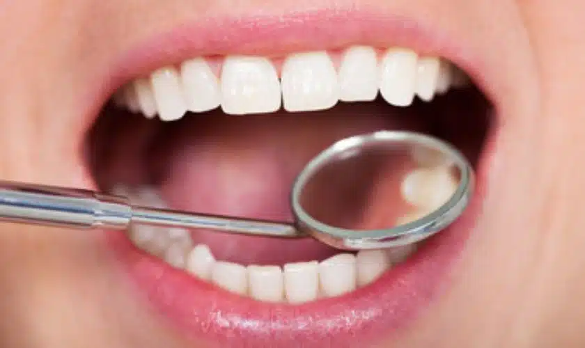 Oral Hygiene Treatment in Kumbakonam – Nalamm Dental Cosmetiks