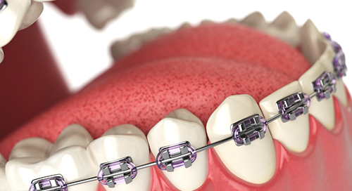 Orthodontics Price in Kumbakonam – Nalamm Dental Cosmetiks