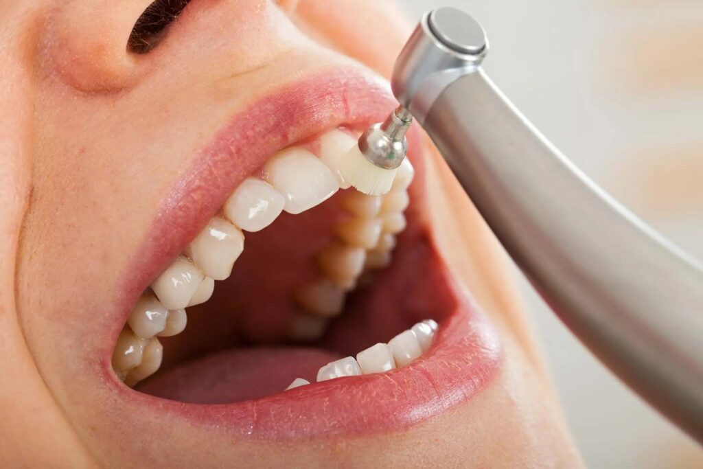Teeth Cleaning Near Me in Kumbakonam – Nalamm Dental Cosmetiks