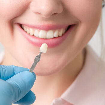 Veneer Whitening Treatment in Kumbakonam – Nalamm Dental Cosmetiks