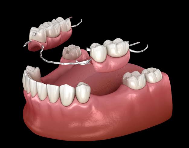 Dentures Teeth Treatments Near Me – Nalamm Dental Cosmetiks