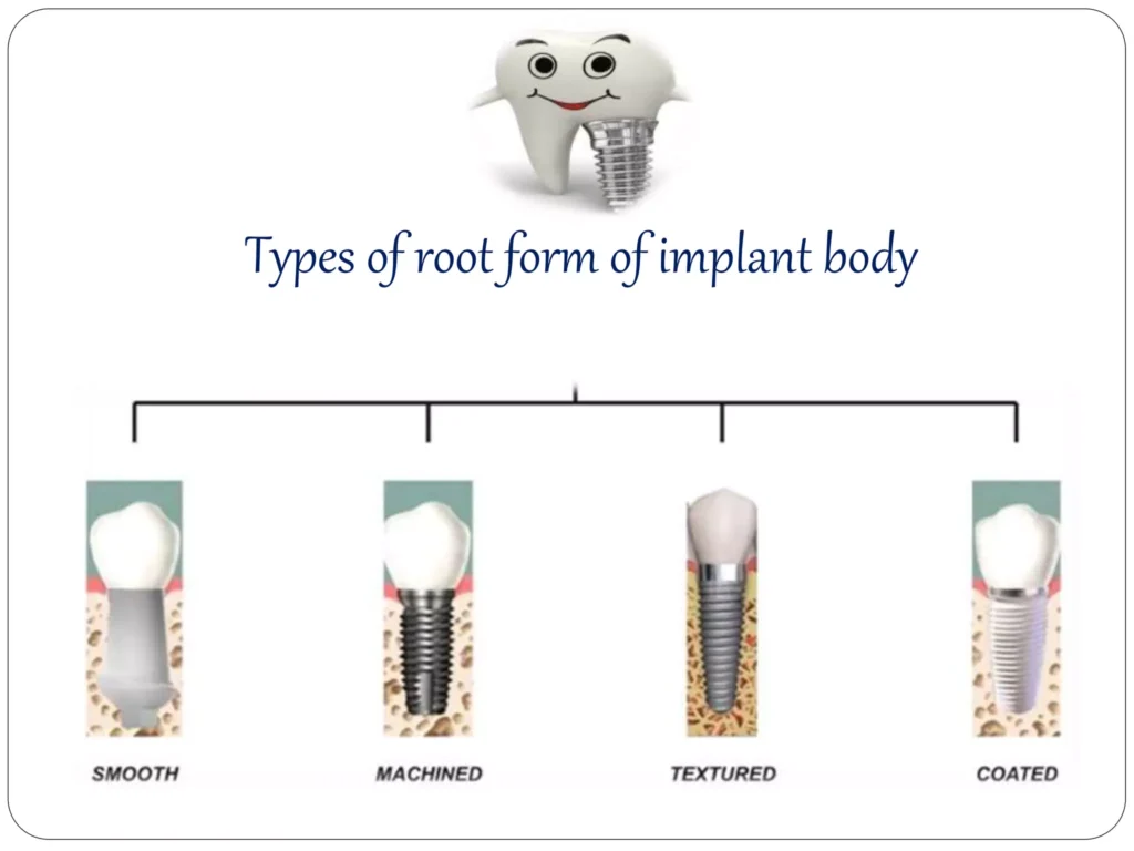 Implant Components and Function | PPTX in Kumbakonam – Nalamm Dental Cosmetiks