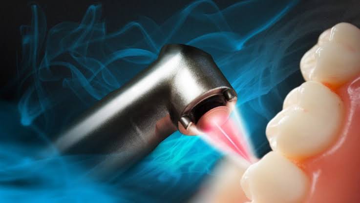Affordable Laser Dentistry Treatment in Kumbakonam – Nalamm Dental Cosmetiks