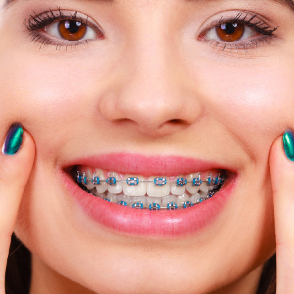 “Transform Your Smile with Confidence – Expert Braces Treatment at Nalamm Dental Cosmetiks in Kumbakonam.”