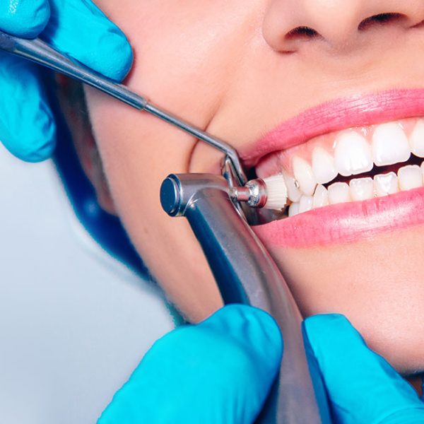 Bright Smiles Start Here: Professional Teeth Cleaning at Nalamm Dental Cosmetiks in Kumbakonam
