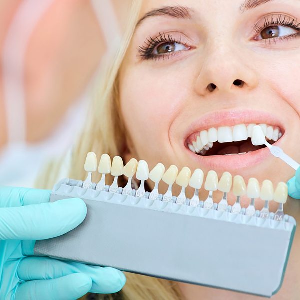 "Brighten Your Smile with Professional Teeth Whitening Services – Nalamm Dental Cosmetiks"