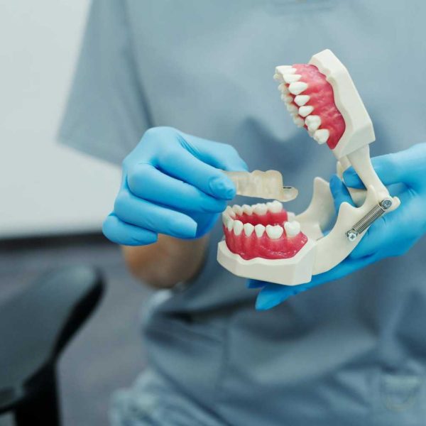 “Metal Free Crowns Services @ Nalamm Dental Cosmetiks in Kumbakonam: Redefining Natural Smiles.”
