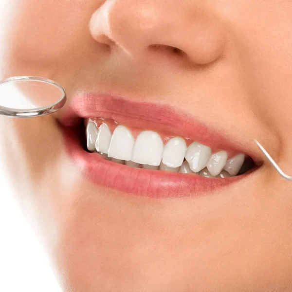 "Smile Brighter: Expert Teeth Care – Nalamm Dental Cosmetiks"