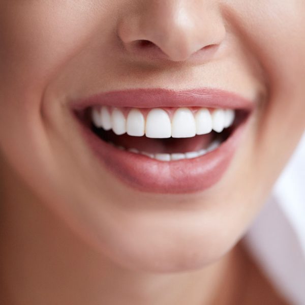 "The Secret to a Flawless Smile: White Veneer Teeth – Nalamm Dental Cosmetiks in Kumbakonam"