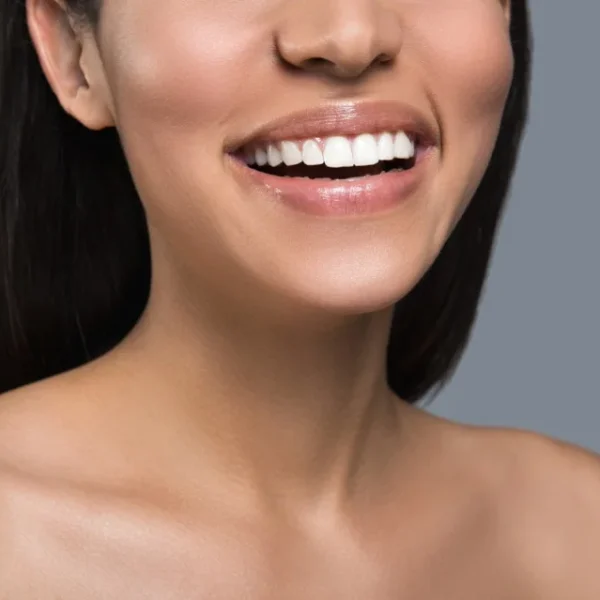 Say hello to a flawless smile! Discover expert white veneer teeth solutions at Nalamm Dental Cosmetiks in Kumbakonam.