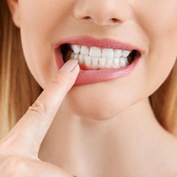 Transform Your Smile: Gum Reshaping Cost & Treatment at Nalamm Dental Cosmetiks in Kumbakonam