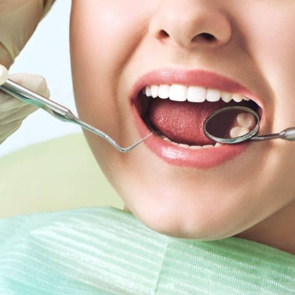 Your Smile Deserves the Best – Routine Dental Checkups at Nalamm Dental Cosmetiks